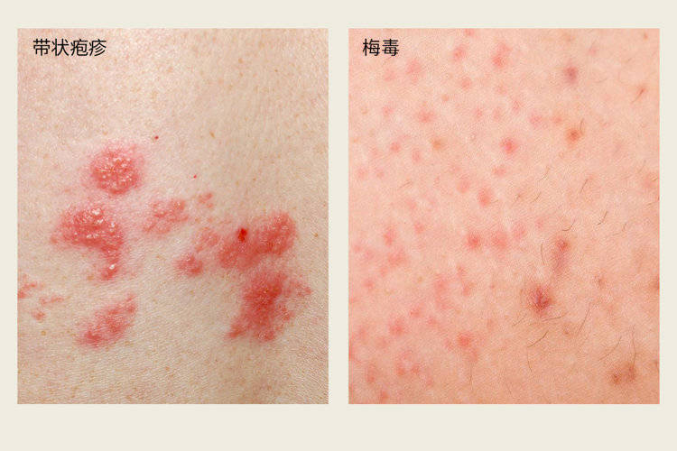 性生活对女性有哪些好处(如何判断对方有没有性病)