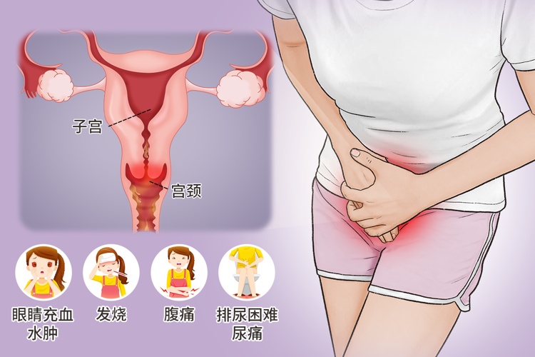 性生活对女性有哪些好处(如何判断对方有没有性病)