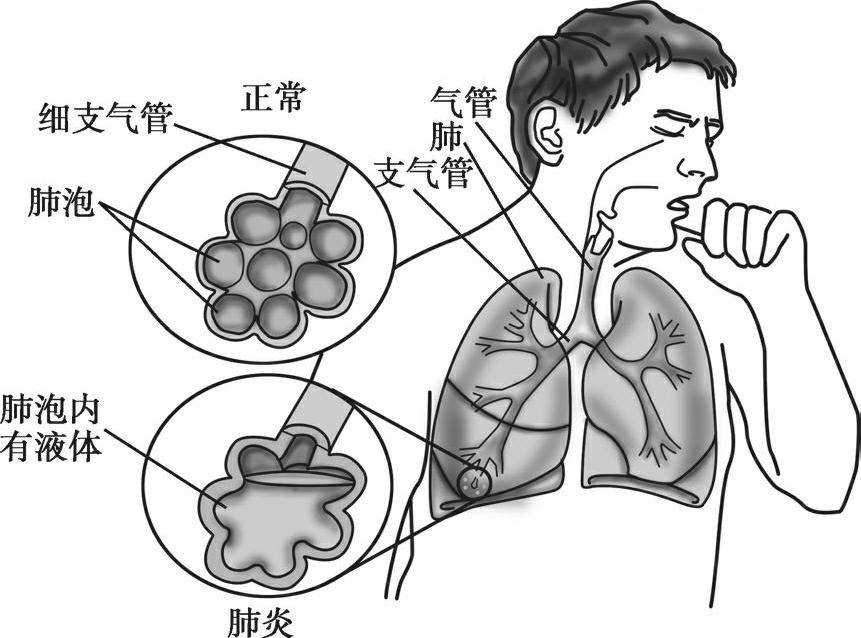 孩子咳嗽带血先观察还是赶紧去医院,一文说清楚