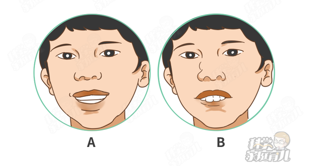 孩子腺样体肥大，应不应该手术切除？