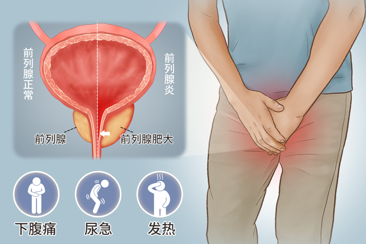 男性阴部潮湿是什么原因如何预防(男性下半身衰老有哪些症状)
