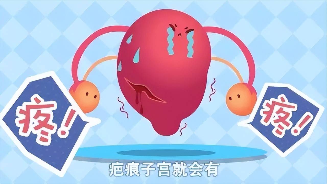剖腹产有哪些后遗症(附4大后果)