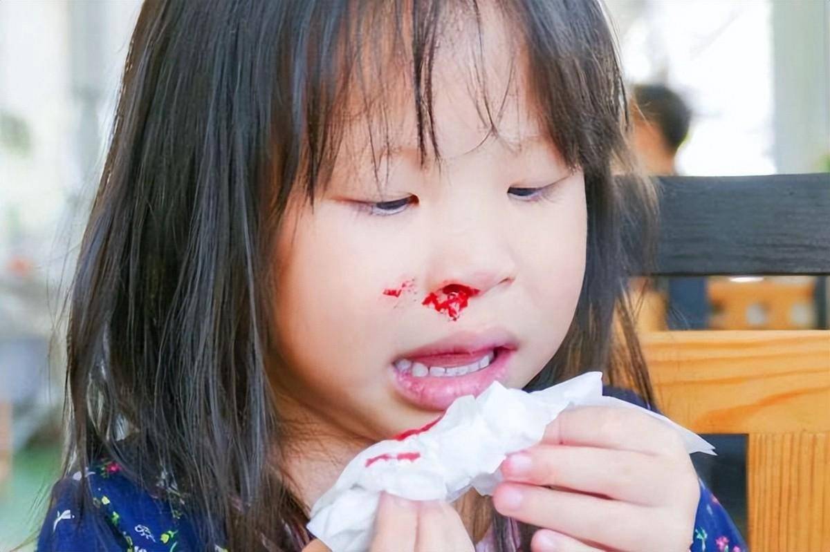 幼儿父母必学几个实用的儿童急救方法,建议收藏