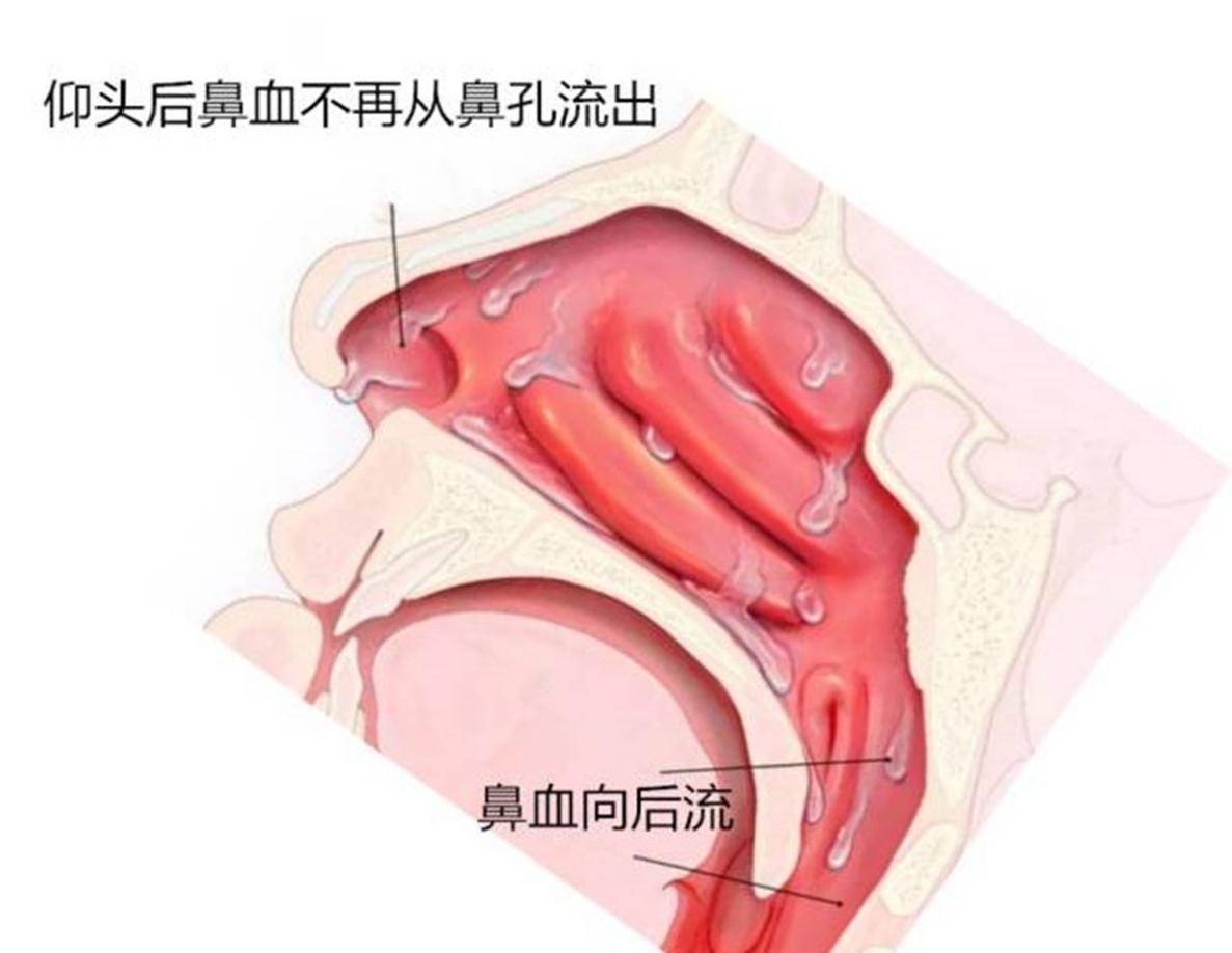 幼儿父母必学几个实用的儿童急救方法,建议收藏