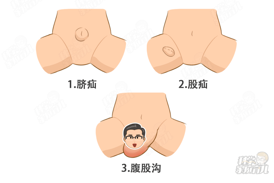 如何判断小孩有疝气？