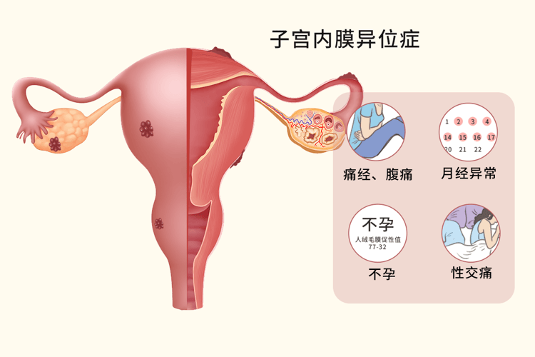 45绝经和54绝经哪个衰老的早(绝经的对女性有哪些好处)