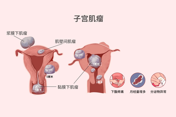 45绝经和54绝经哪个衰老的早(绝经的对女性有哪些好处)