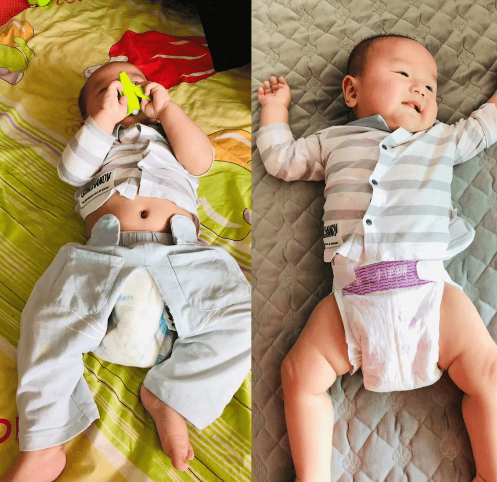 宝宝为什么会红屁股(宝宝红屁屁怎么预防)