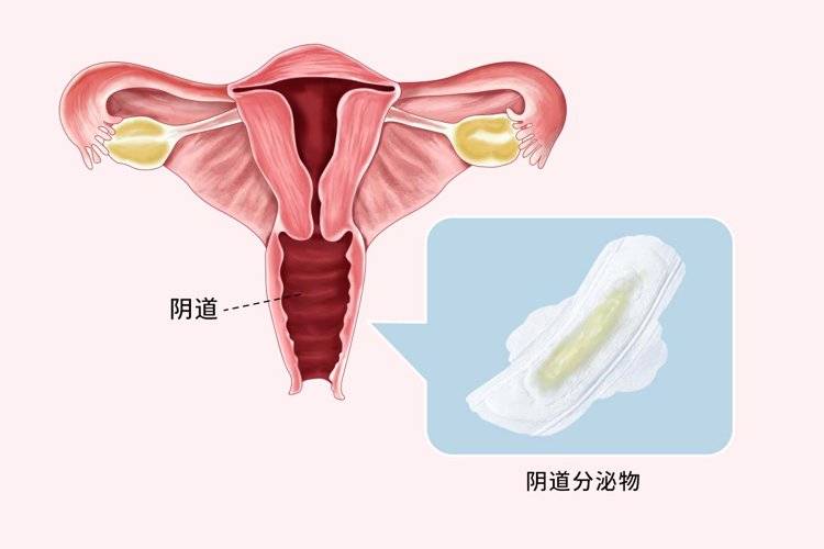 宫颈癌与HPV感染有关吗(宫颈癌的六个信号和三级预防)