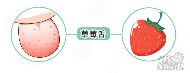 孩子患有猩红热的症状有哪些？