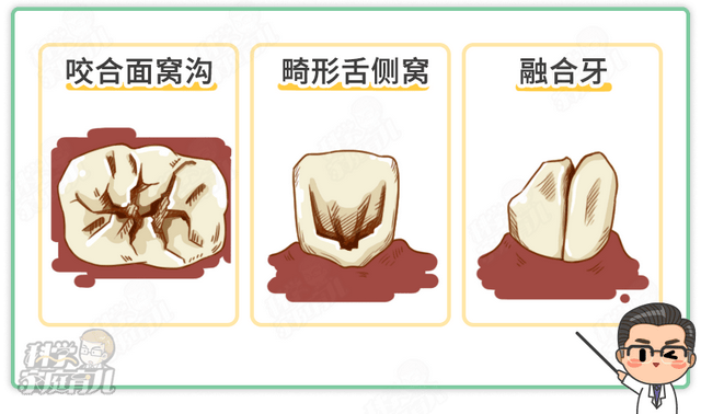 有龋齿能做窝沟封闭吗？