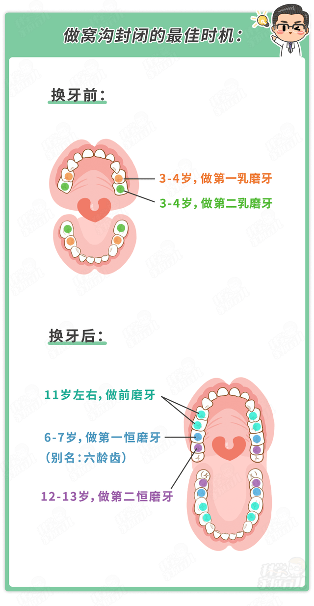 有龋齿能做窝沟封闭吗？