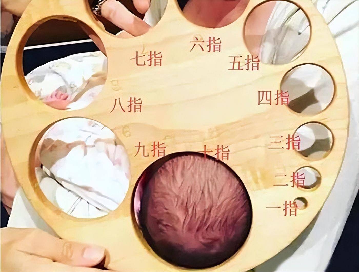 宫颈开10指有多大(开宫口有多疼)