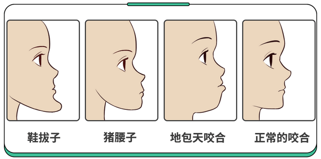 儿童牙齿出现哪些情况需要矫正？乳牙滞留如何处理？