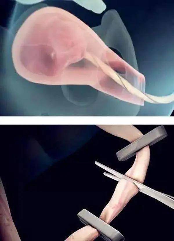 顺产为什么疼痛难忍?10张图带你看顺产分娩全过程,心疼各位宝妈