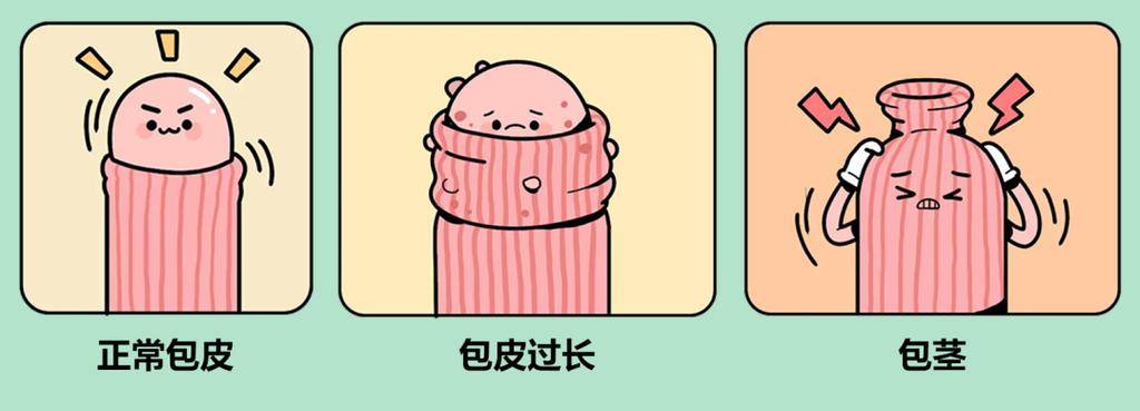 怎么测试龟头是不是敏感(怎么降低龟头敏感度)