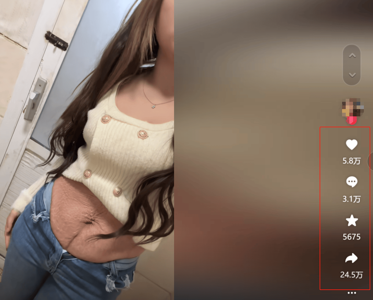 26岁女子晒出自己产后布满妊娠纹的肚子,产后身材走形的原因？