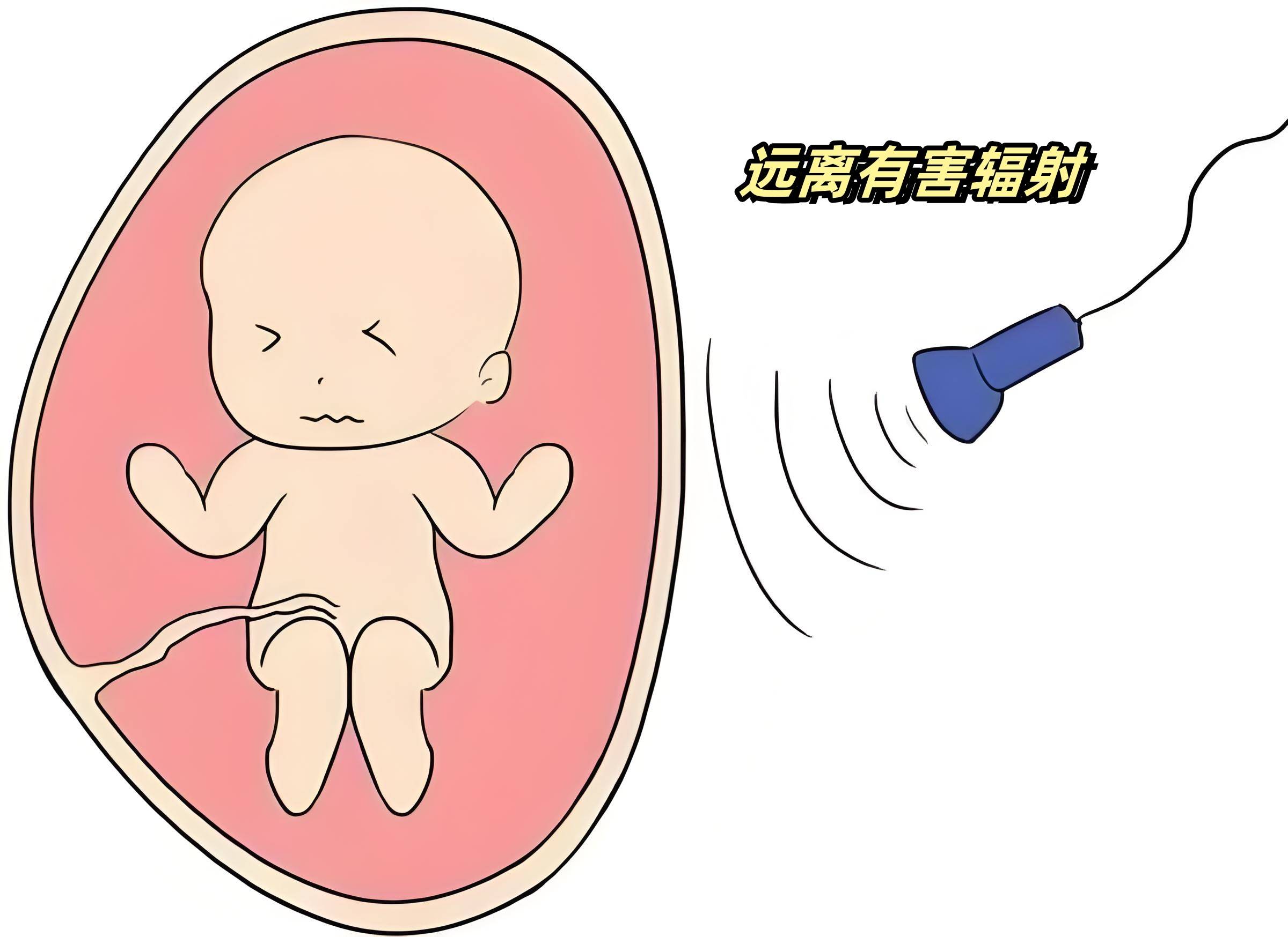 唐氏综合征为什么长一样？与这个原因有关系,爸妈要明白