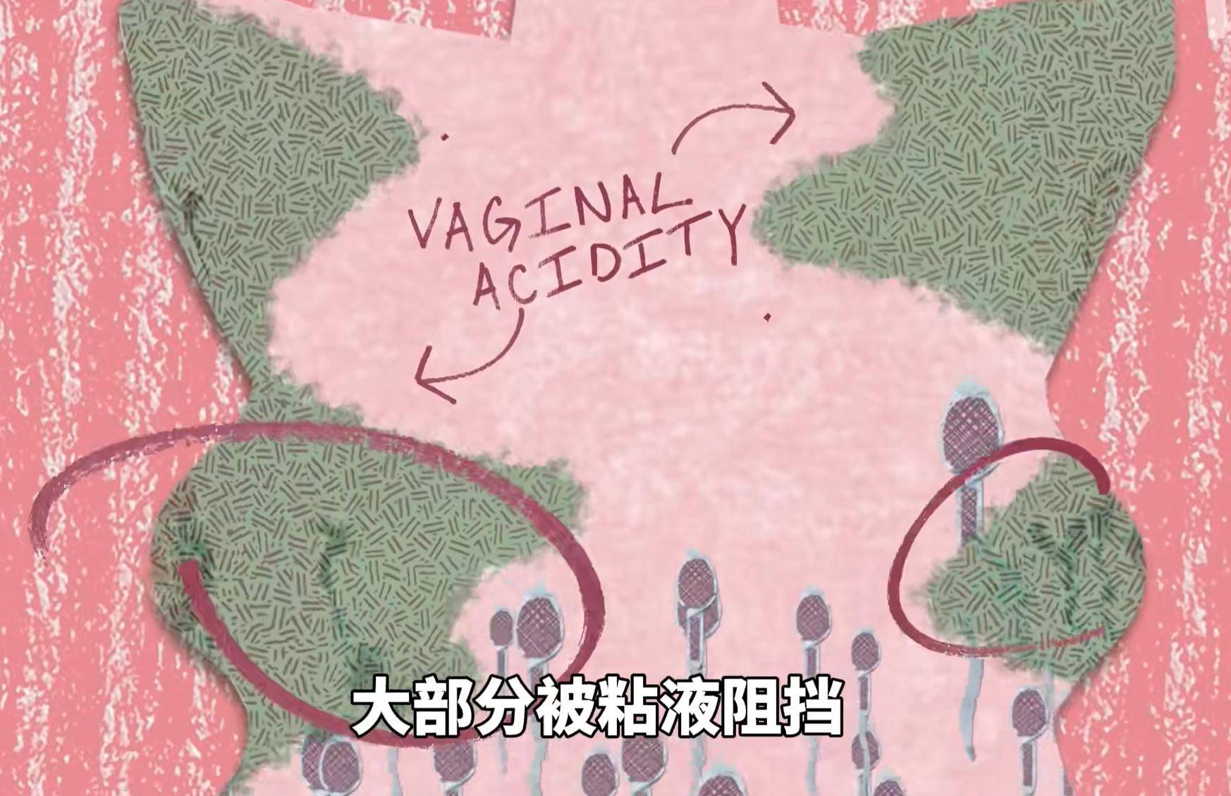 精子进入女性体内后没受精去哪儿了？