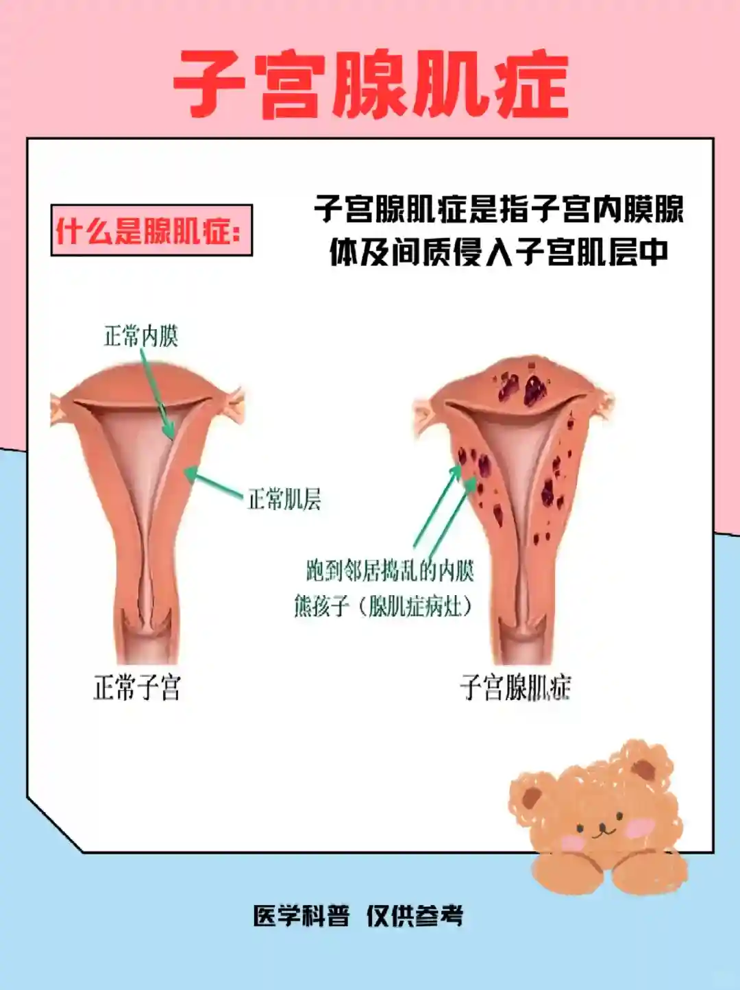 什么是子宫腺肌症？看看症状、宜吃食物与雷区