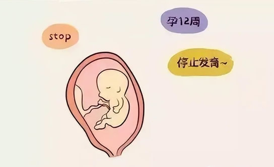 胎停育有哪些征兆(怎么判断是不是胎停了)