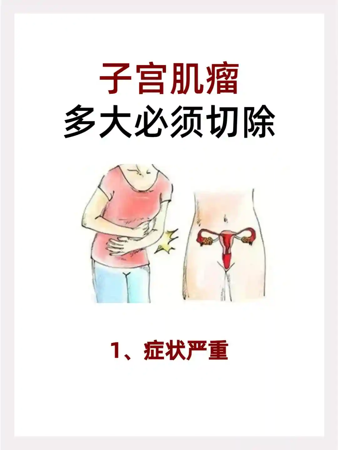 妇科医生告诉你子宫肌瘤多大必须切除？如何预防子宫肌瘤发生
