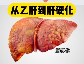 好消息！治愈慢性乙肝有希望！乙肝病毒的“开关”被找到了