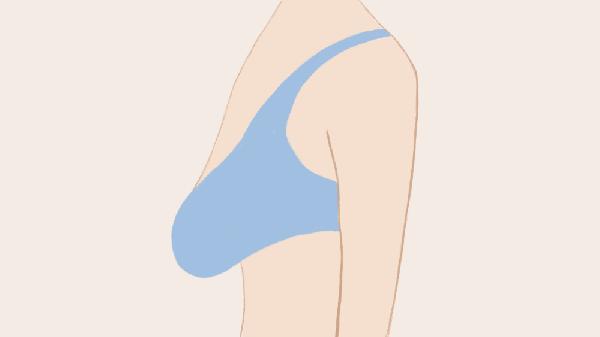 喂奶后出现乳房下垂怎么办