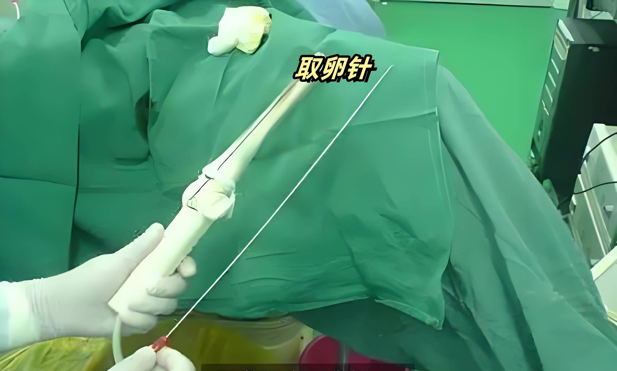 医生：“接受老婆借精生娃吗？”弱精男子：“太丢人！做试管”