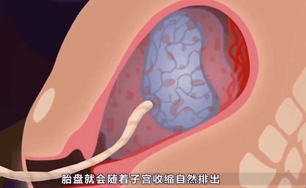 3D图还原顺产的三个产程,第三阶段让妈妈集体破防