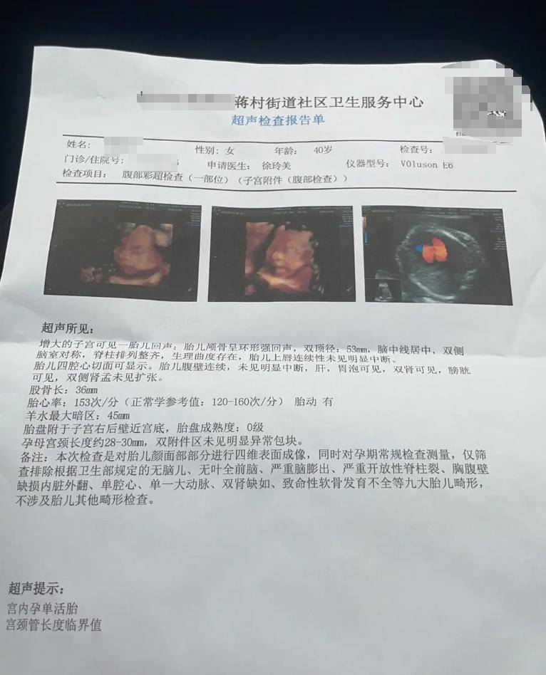 大龄剩女嫁二婚男：4次胎停后23周羊水早破,保胎失败无奈流产
