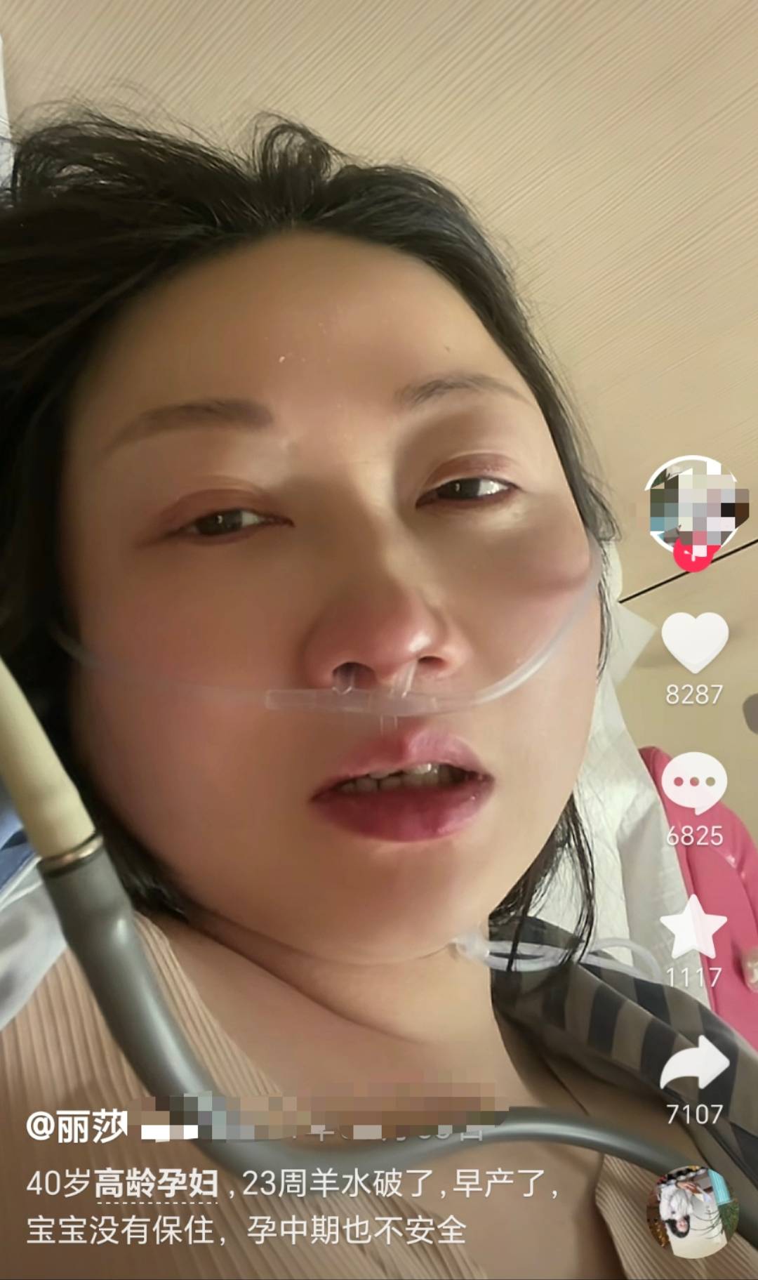大龄剩女嫁二婚男：4次胎停后23周羊水早破,保胎失败无奈流产