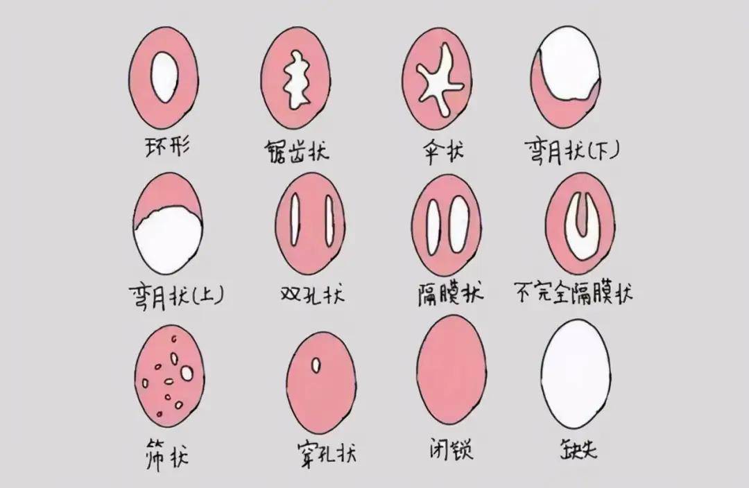 女性私处5个关键小秘密,你都清楚吗？