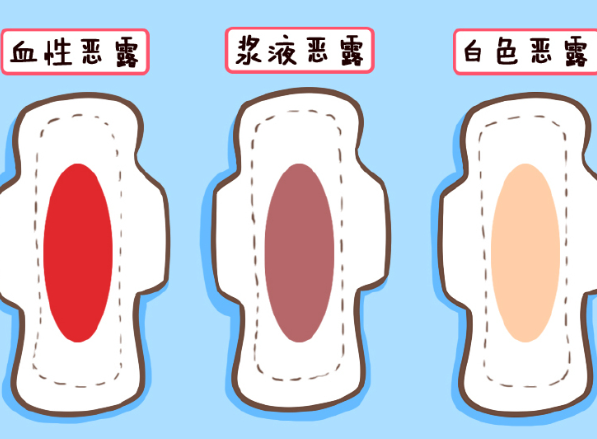 产后恶露颜色有多种,出现黑色需警惕宫腔内感染