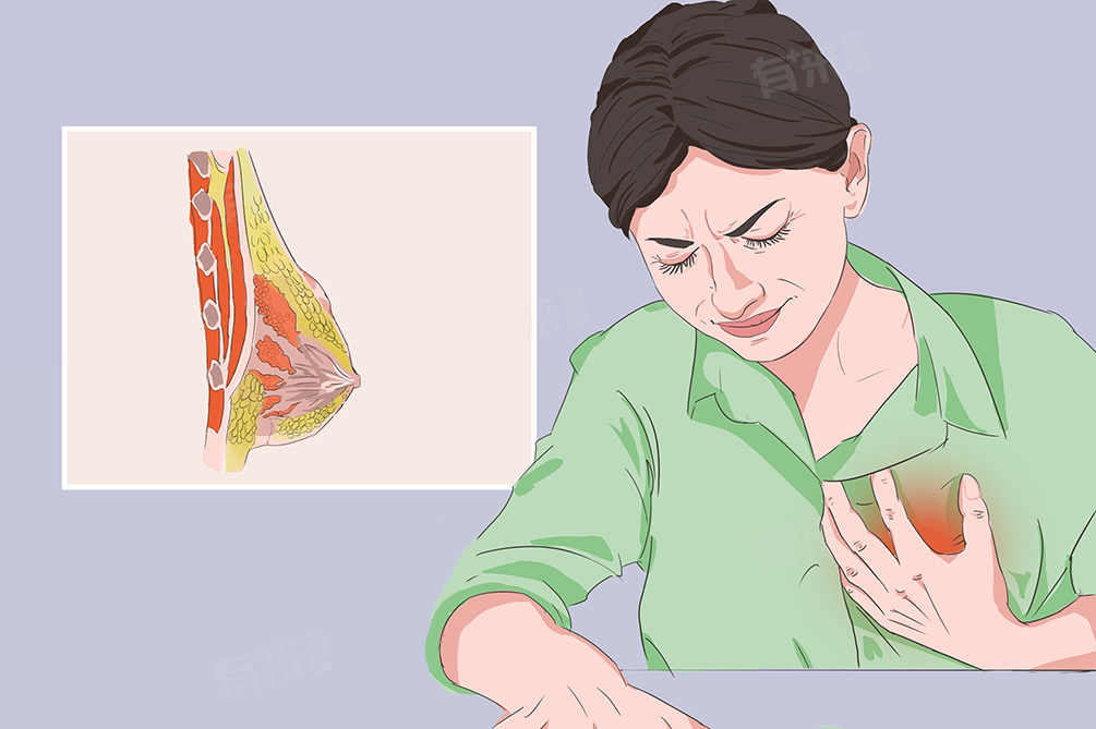 乳房里有一个硬块一按就疼是怎么回事？附如何护理