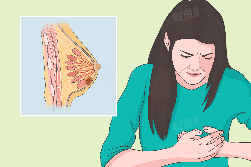 乳头旁边有大疙瘩是什么原因 乳头旁边有大疙瘩需要如何改善