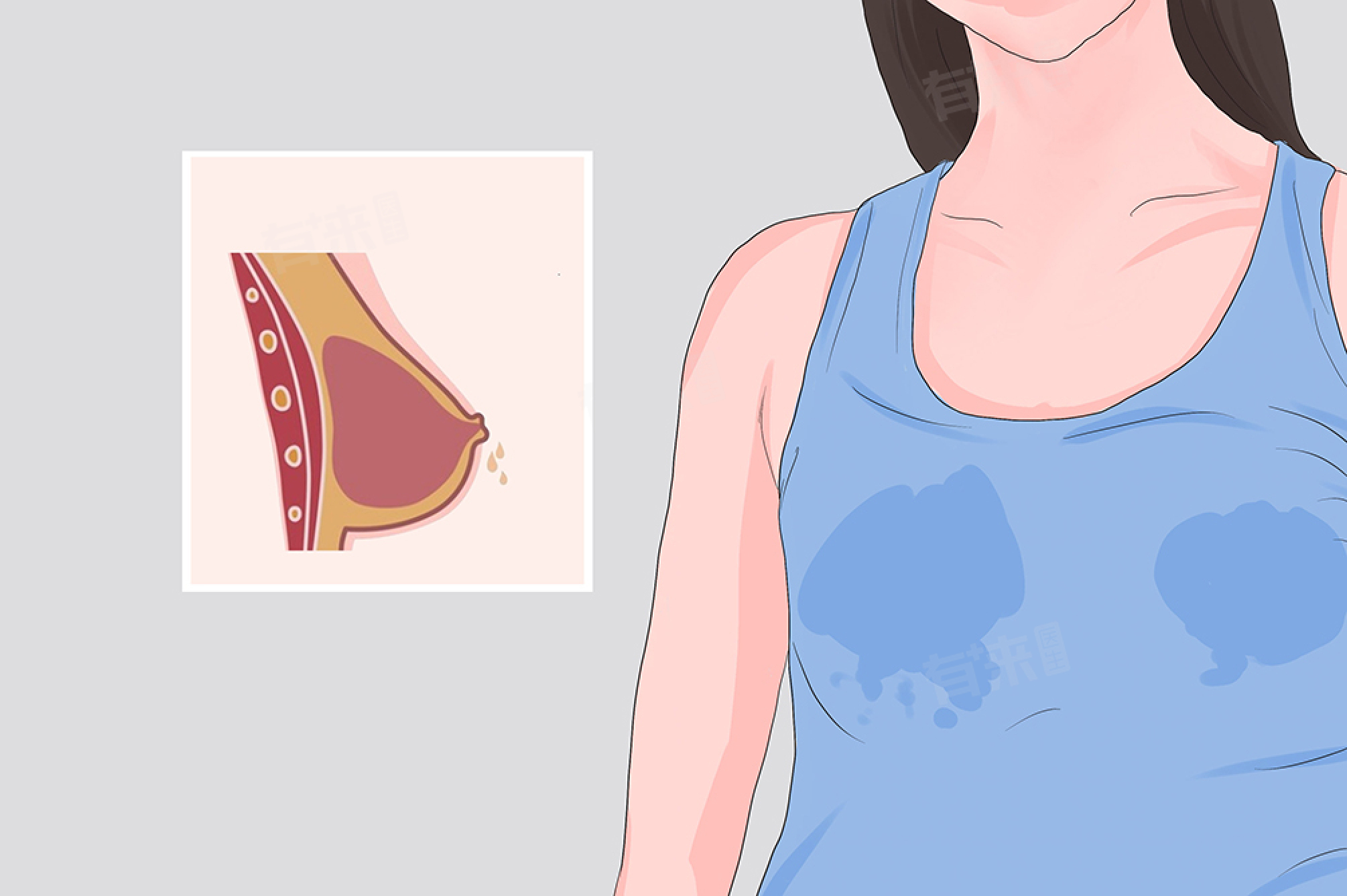 乳头出现液体是怎么回事 乳头出现液体需要如何缓解