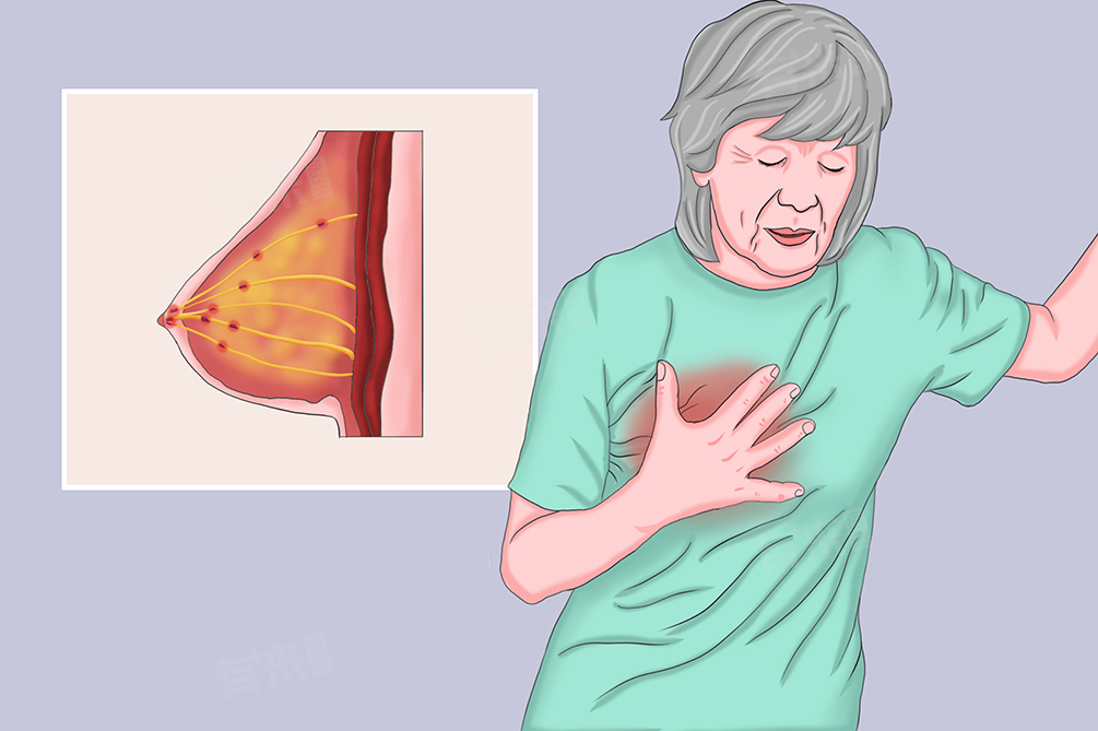 乳头疼怎么解决 乳头疼需要做哪些检查明确情况