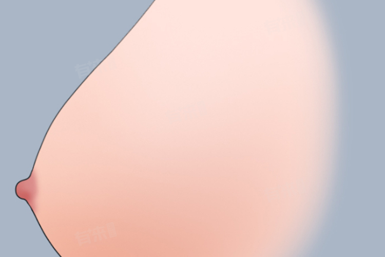 经常用吸奶器吸奶对乳房有影响吗？附注意事项