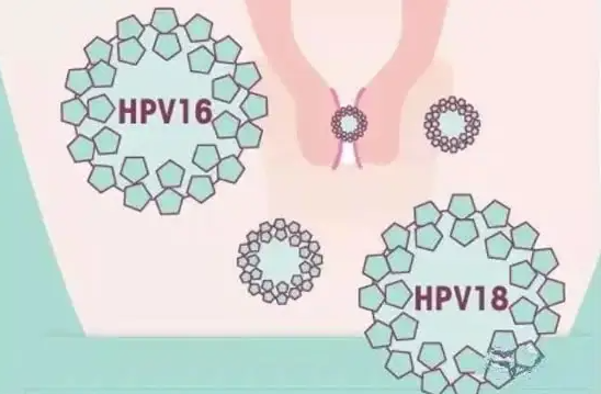 一夫一妻是怎么感染上hpv的？真相往往可能出乎你的意料