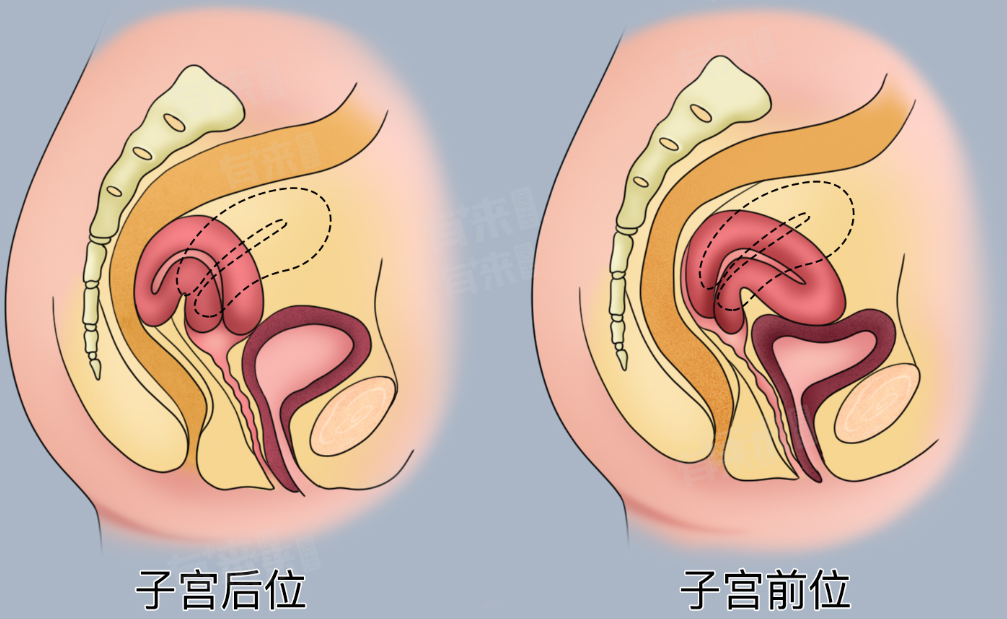 子宫前位是不是肚子更显大？子宫前位怀孕时的注意要点