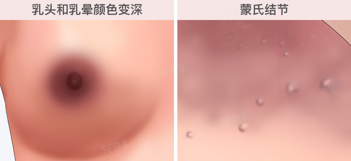 着床后有什么感觉和症状？