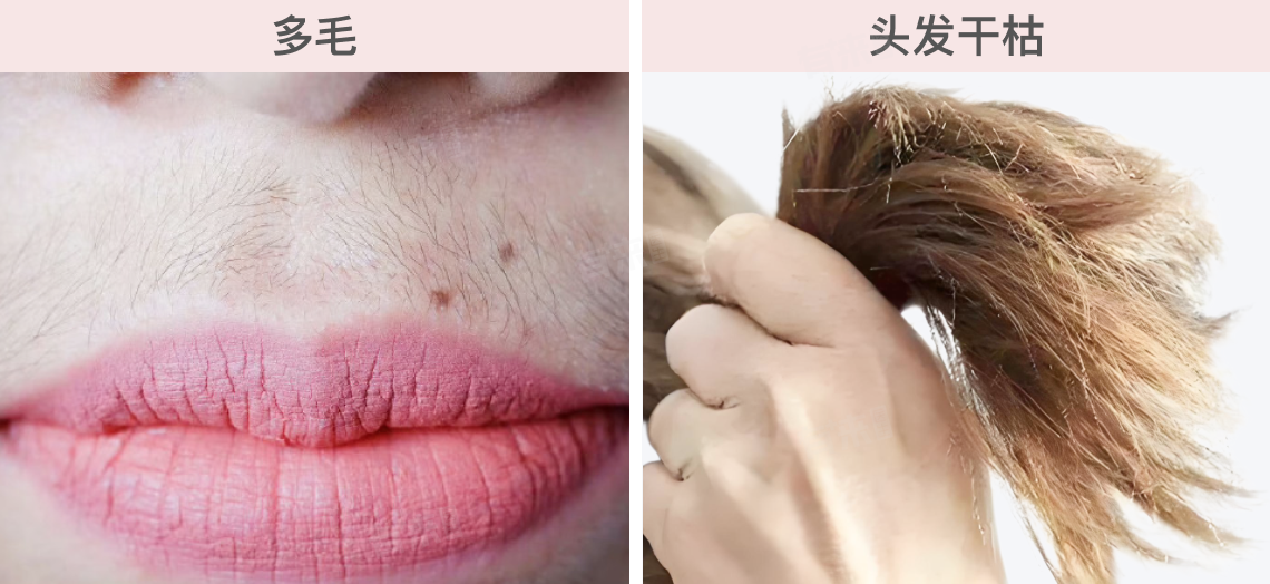 内分泌失调的女人有什么表现？