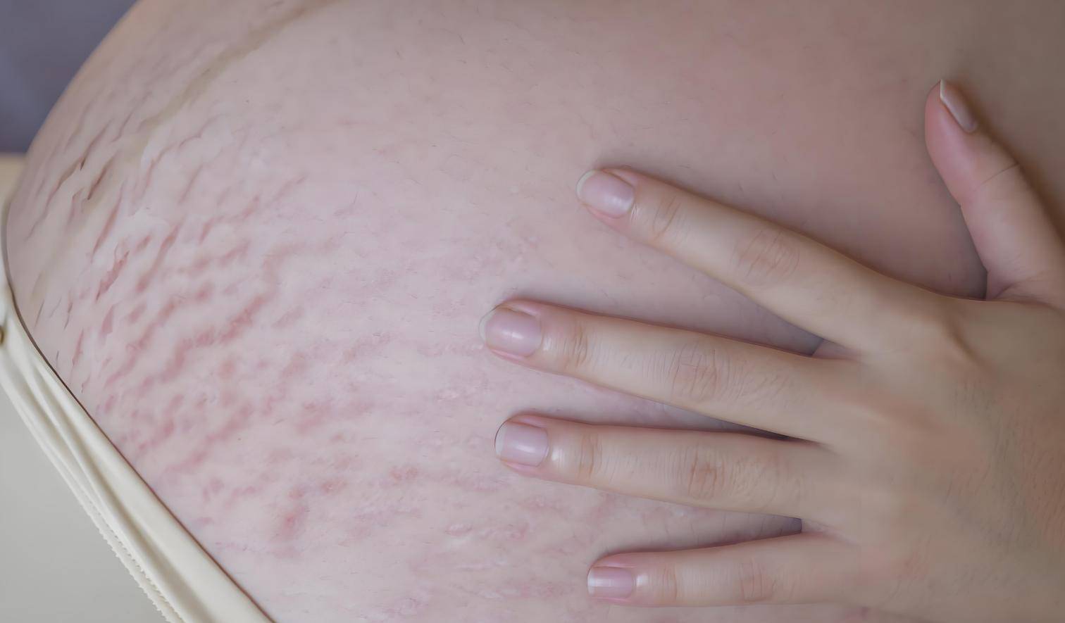 孕妇孕期身材变化,附孕妇选美审美竞赛