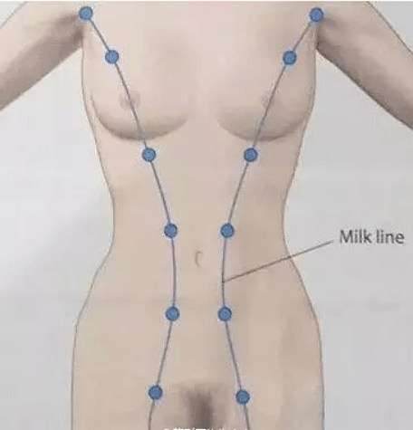 怀孕后长副乳怎么回事？关于副乳的真相