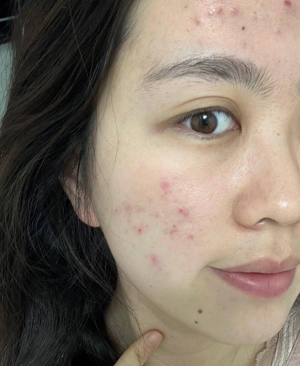 怀孕变丑了是怎么回事?医生说出原因