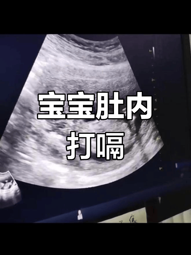 孕晚期胎动像心跳一样是怎么回事?可能是胎儿在打嗝